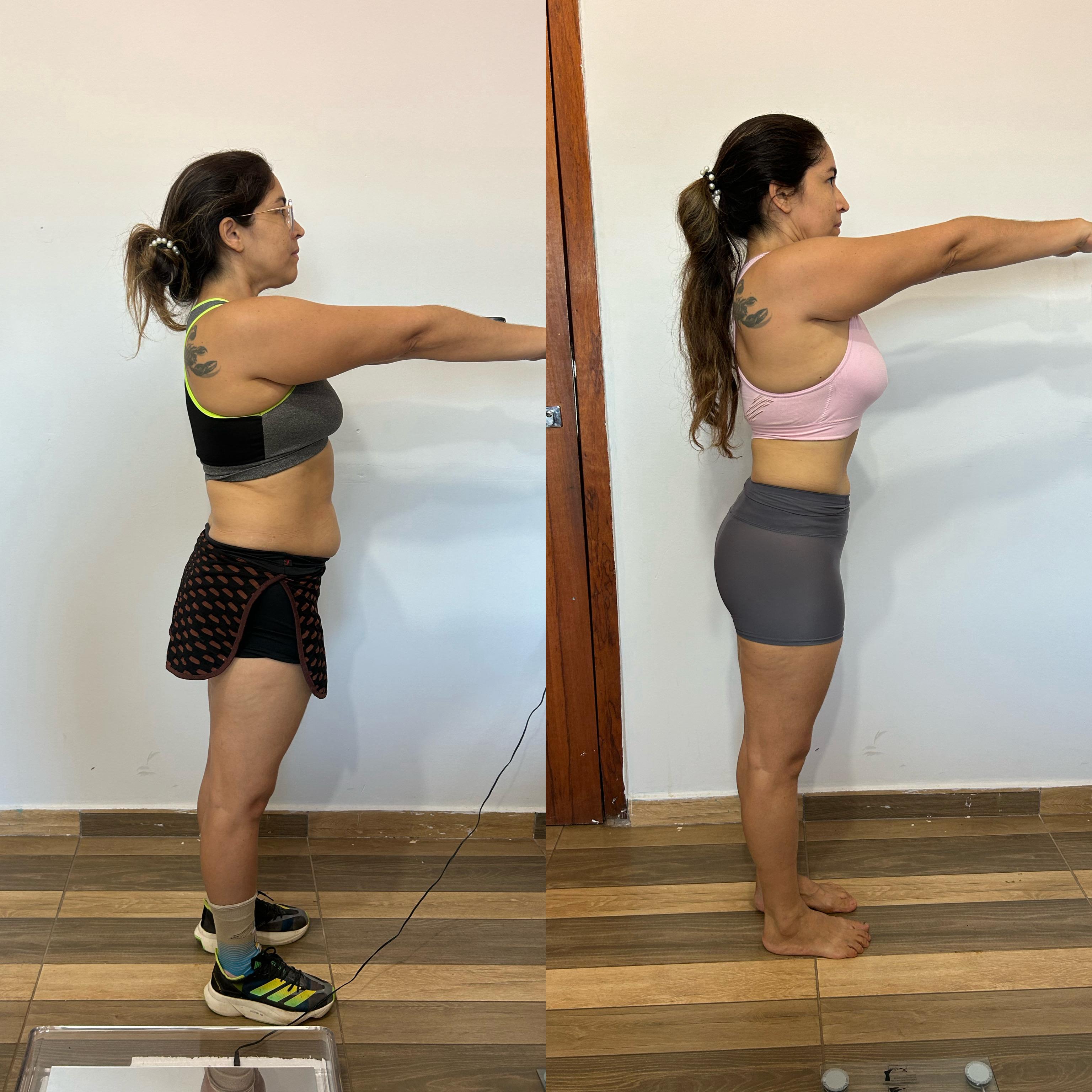 Transformação de Ana P.